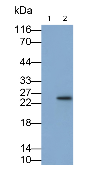 Polyclonal Antibody to Interleukin 6 (IL6)