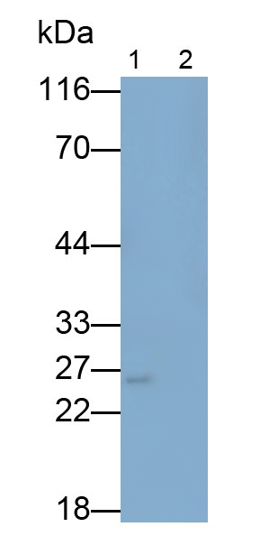 Polyclonal Antibody to Interleukin 6 (IL6)