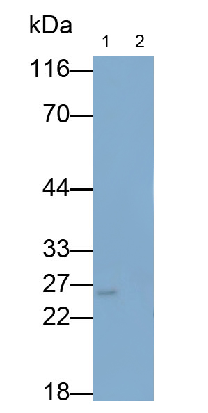 Polyclonal Antibody to Interleukin 6 (IL6)