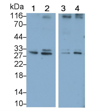 Polyclonal Antibody to Interleukin 6 (IL6)