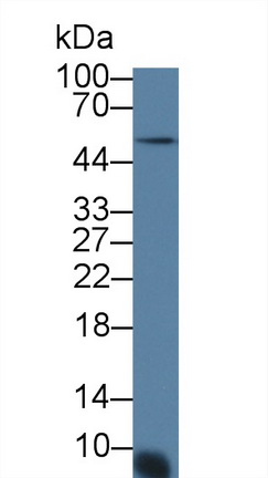 Polyclonal Antibody to Interleukin 8 (IL8)