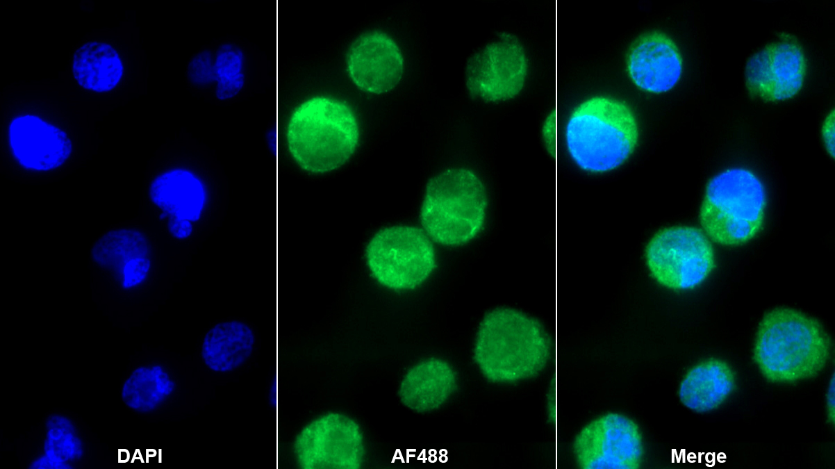 Polyclonal Antibody to Interleukin 8 (IL8)