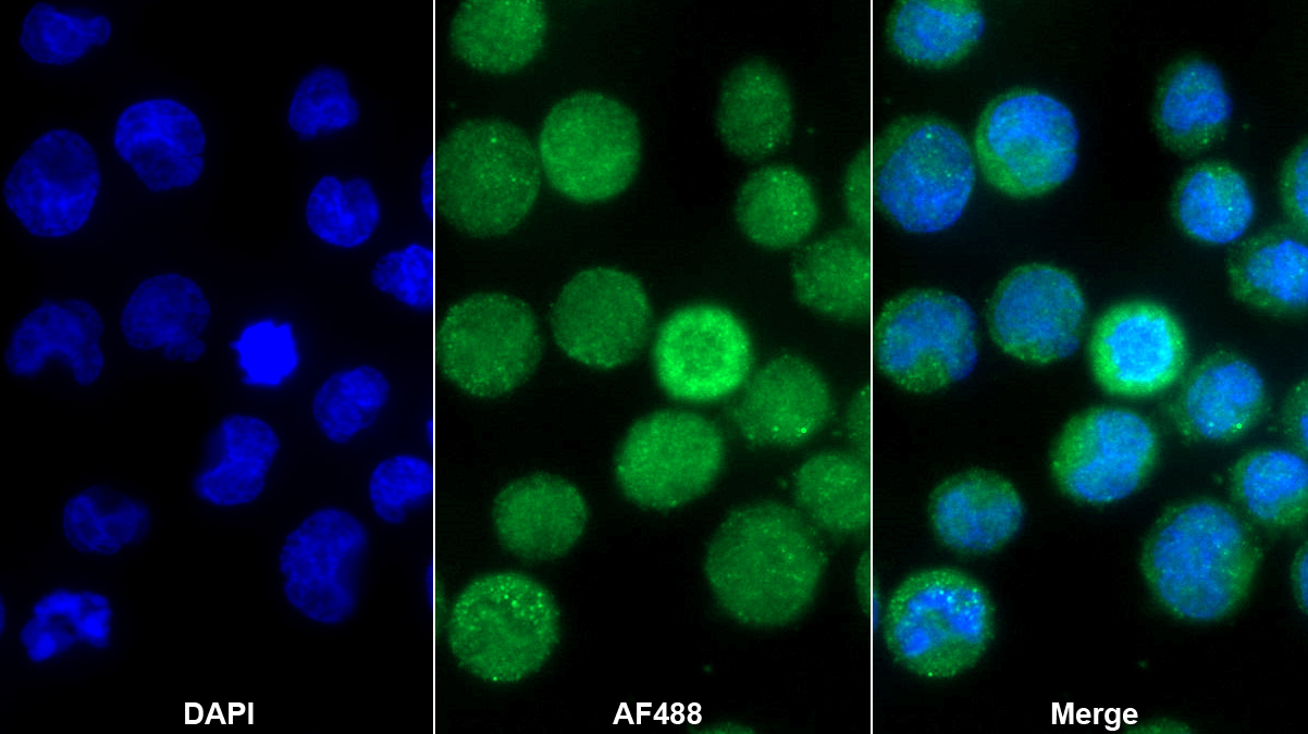 Polyclonal Antibody to Interleukin 8 (IL8)