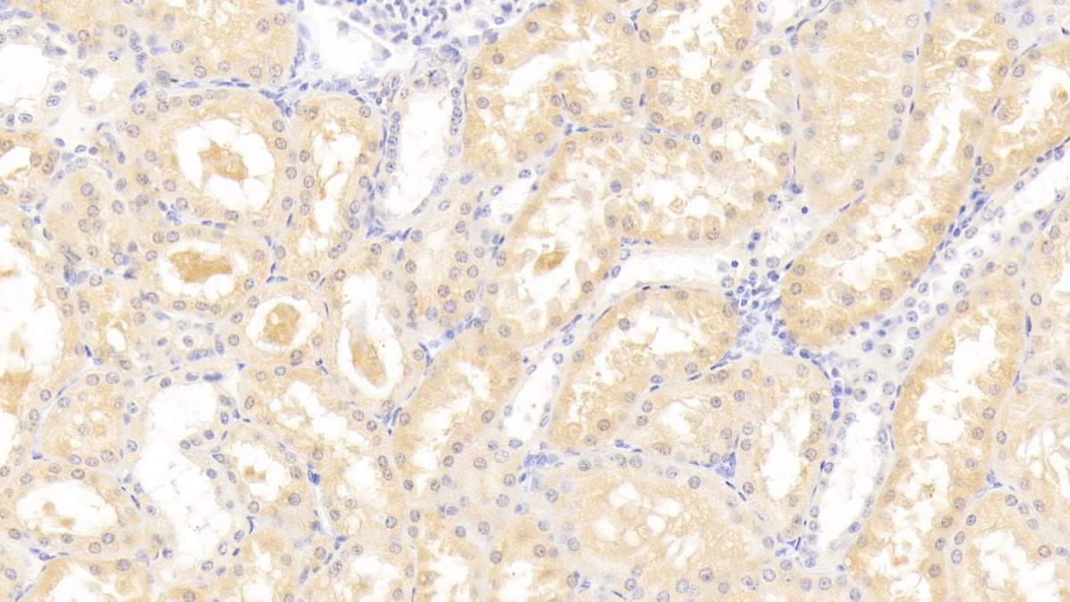 Polyclonal Antibody to Leptin Receptor (LEPR)