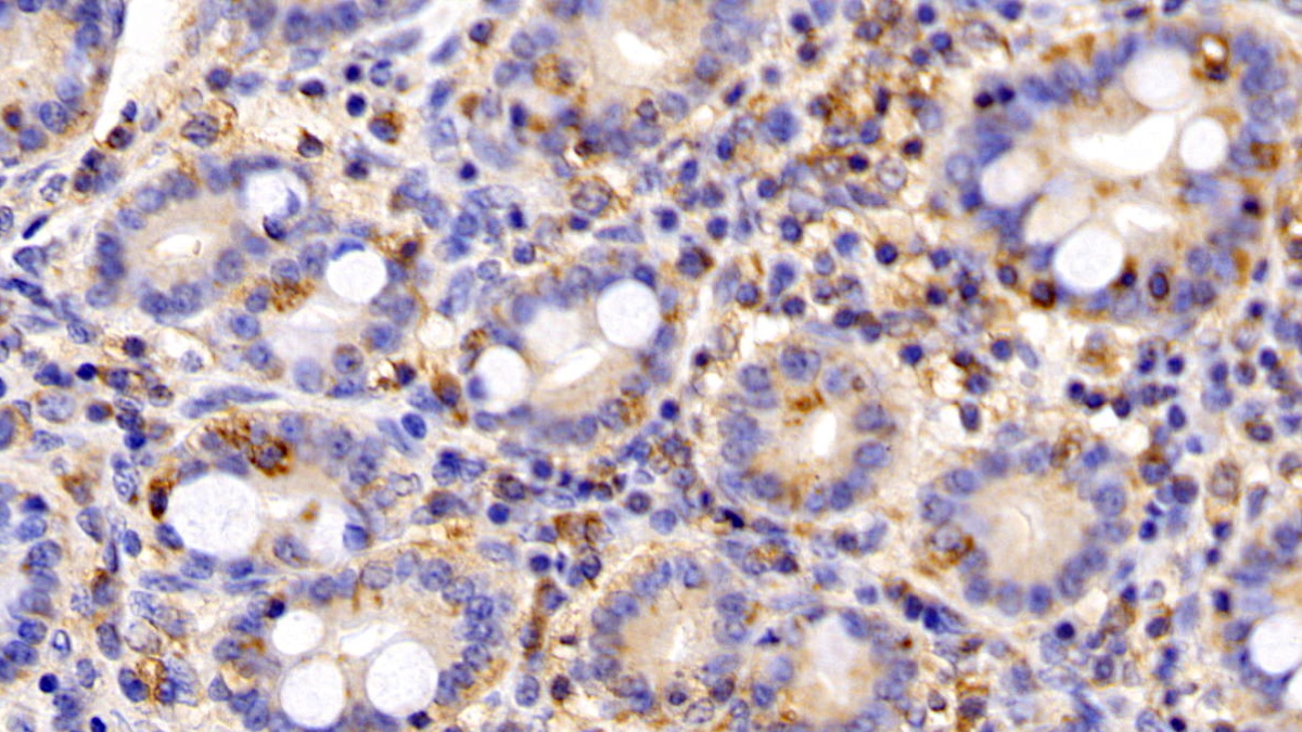 Polyclonal Antibody to Leptin Receptor (LEPR)