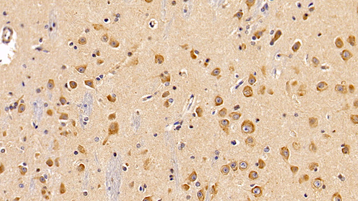 Polyclonal Antibody to Leptin Receptor (LEPR)