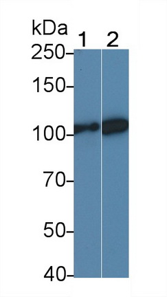 Polyclonal Antibody to Leptin Receptor (LEPR)