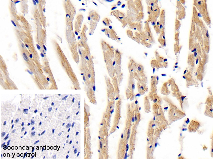 Polyclonal Antibody to Leptin Receptor (LEPR)