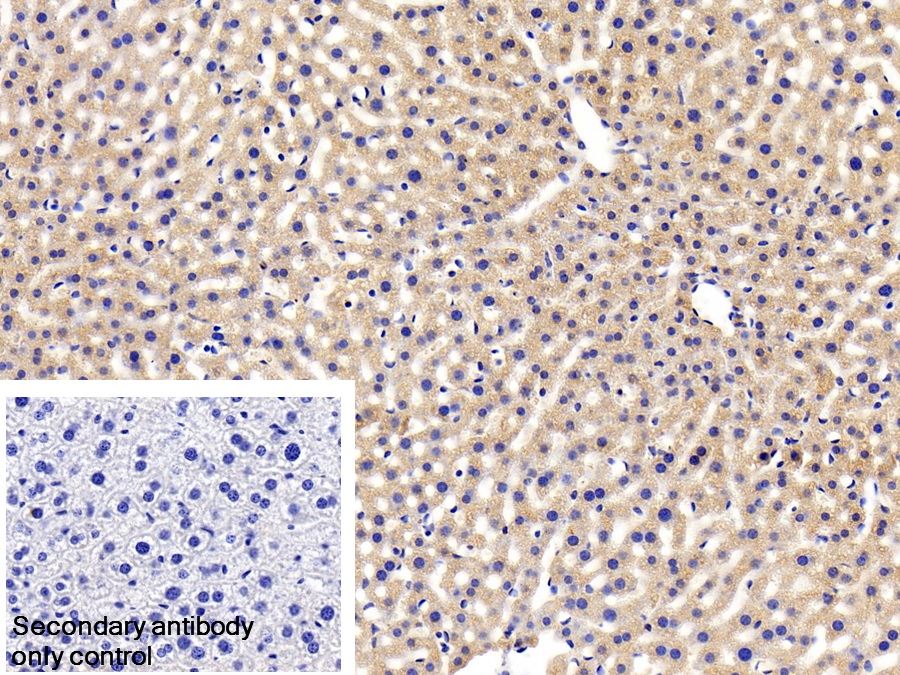 Polyclonal Antibody to Leptin Receptor (LEPR)