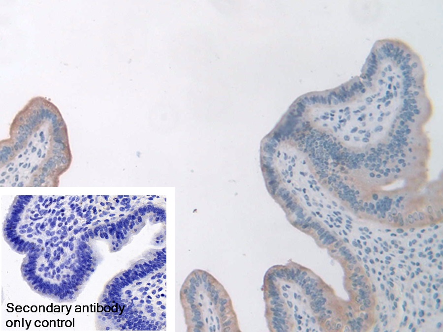 Polyclonal Antibody to Leptin Receptor (LEPR)