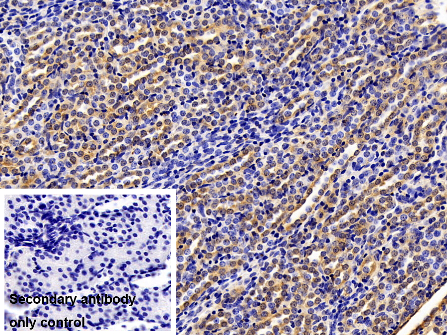 Polyclonal Antibody to Leptin Receptor (LEPR)