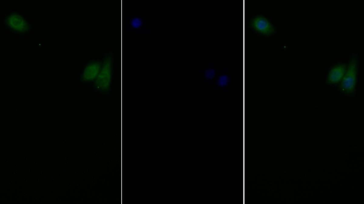 Polyclonal Antibody to Leptin Receptor (LEPR)