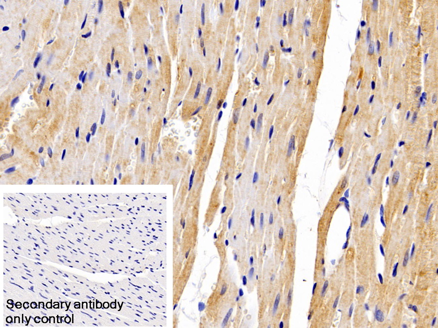 Polyclonal Antibody to Leptin Receptor (LEPR)