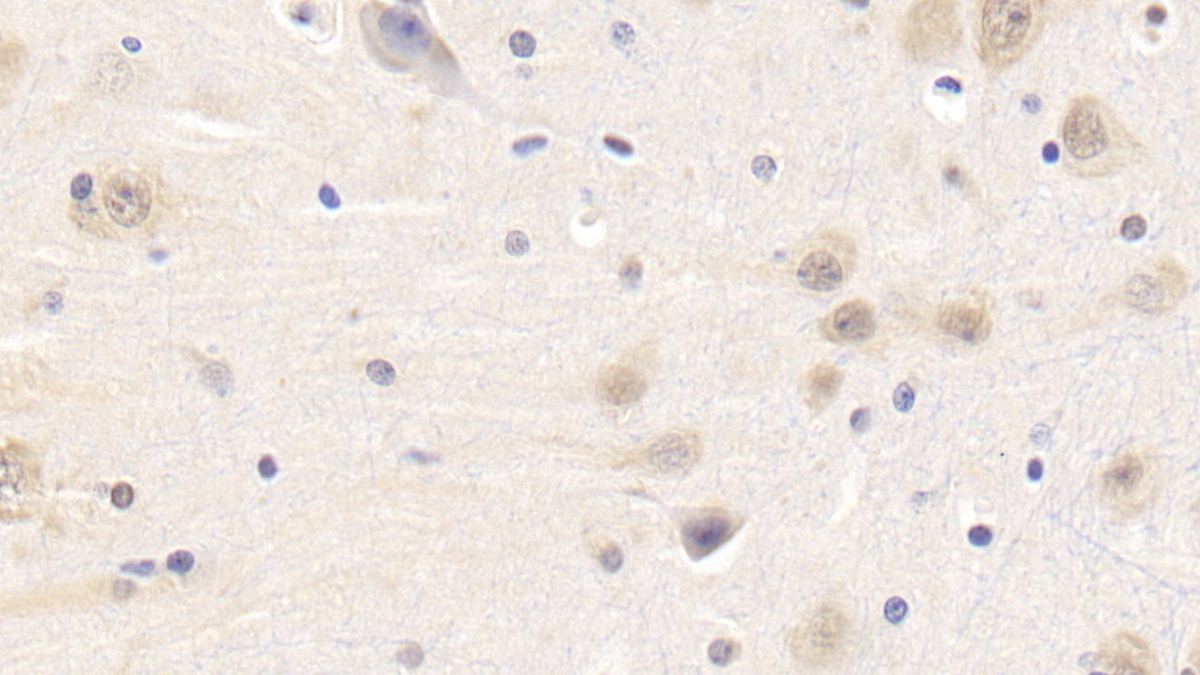 Polyclonal Antibody to Leptin (LEP)