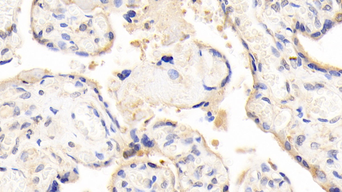 Polyclonal Antibody to Leptin (LEP)