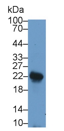 Polyclonal Antibody to Leukemia Inhibitory Factor (LIF)