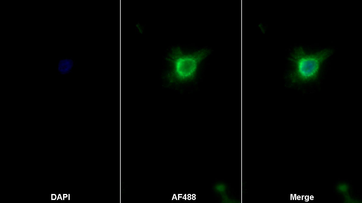 Polyclonal Antibody to Monocyte Chemotactic Protein 1 (MCP1)