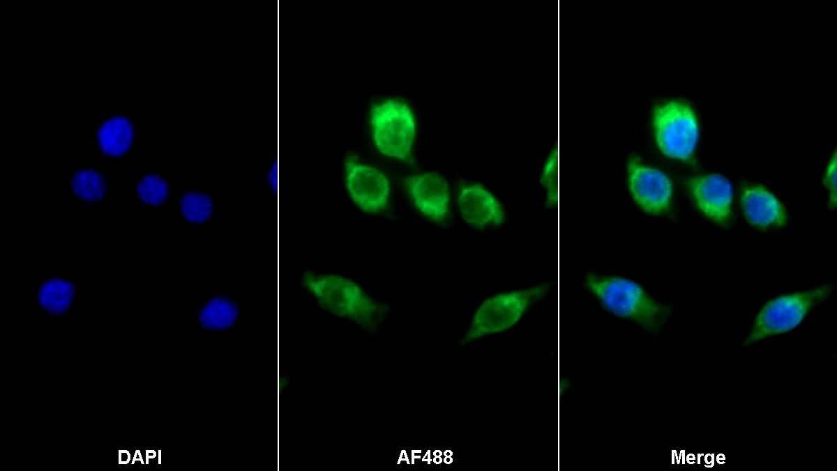 Polyclonal Antibody to Colony Stimulating Factor 1, Macrophage (MCSF)