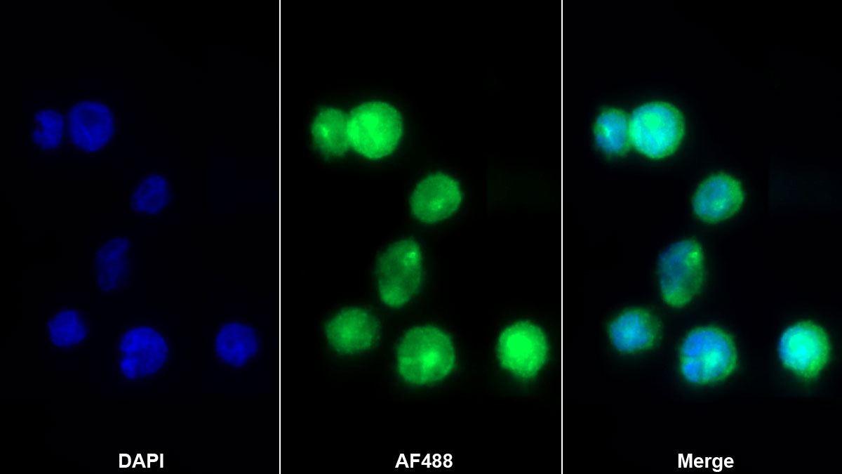 Polyclonal Antibody to Macrophage Derived Chemokine (MDC)