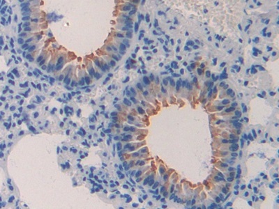 Polyclonal Antibody to Macrophage Inflammatory Protein 1 Beta (MIP1b)