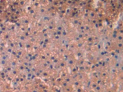 Polyclonal Antibody to Macrophage Inflammatory Protein 1 Beta (MIP1b)