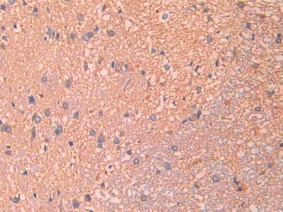 Polyclonal Antibody to Macrophage Inflammatory Protein 1 Beta (MIP1b)