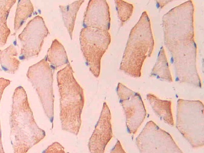 Polyclonal Antibody to Macrophage Inflammatory Protein 1 Beta (MIP1b)