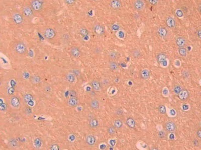 Polyclonal Antibody to Macrophage Inflammatory Protein 1 Beta (MIP1b)