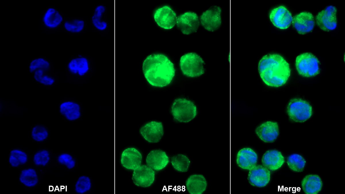 Polyclonal Antibody to Macrophage Inflammatory Protein 1 Beta (MIP1b)