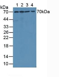 Polyclonal Antibody to Matrix Metalloproteinase 1 (MMP1)