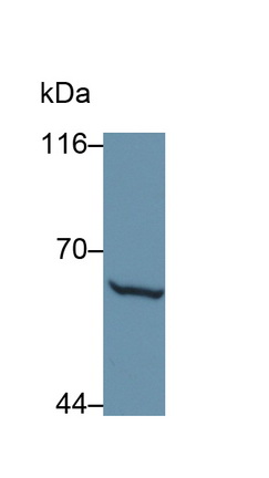 Polyclonal Antibody to Matrix Metalloproteinase 1 (MMP1)