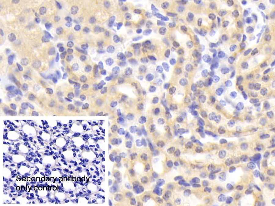 Polyclonal Antibody to Matrix Metalloproteinase 1 (MMP1)