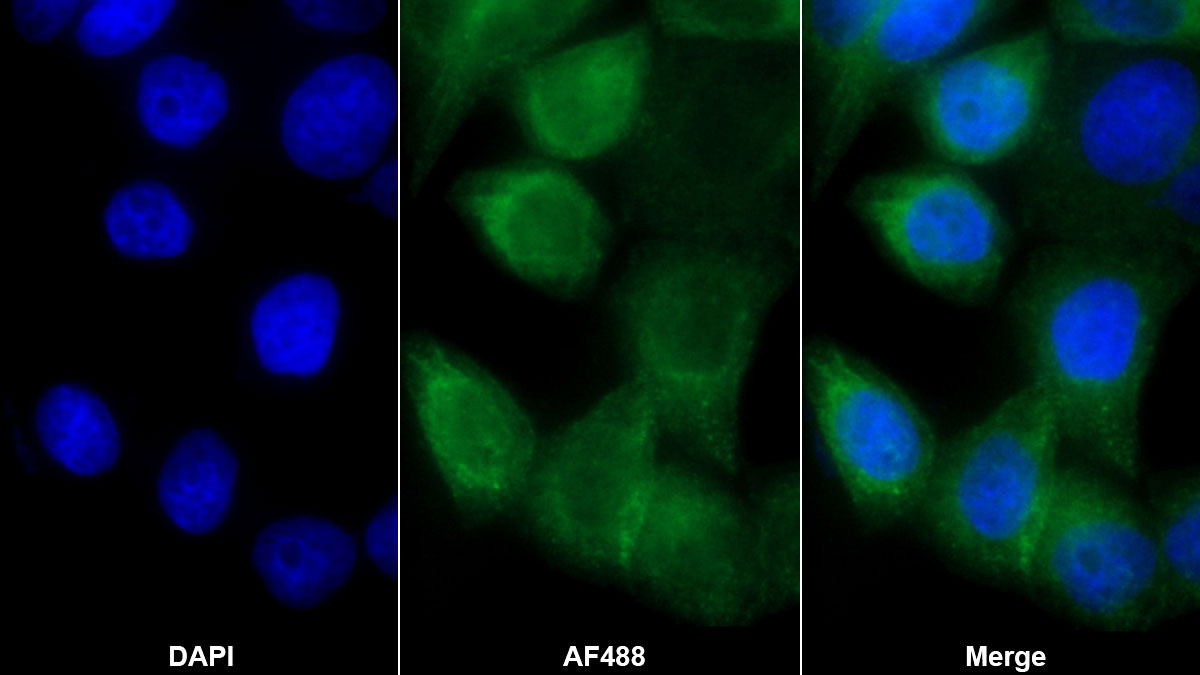 Polyclonal Antibody to Matrix Metalloproteinase 13 (MMP13)