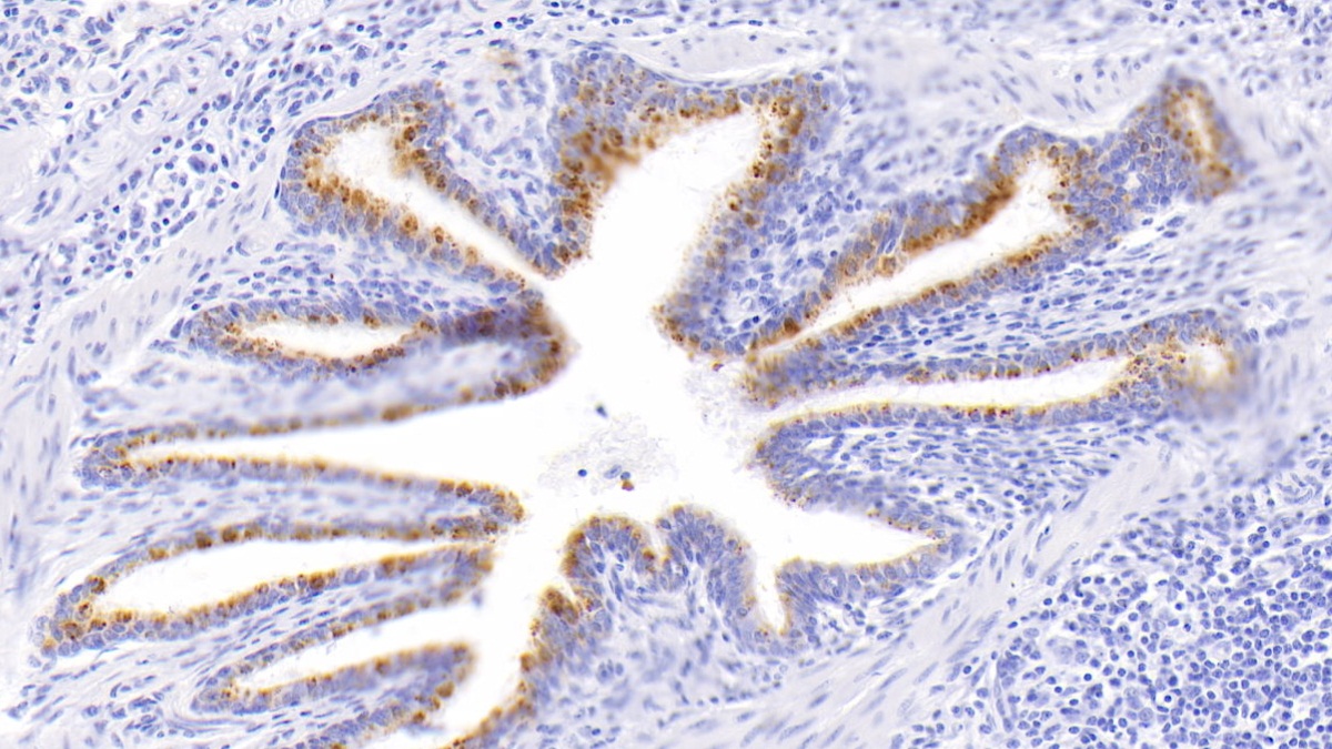 Polyclonal Antibody to Matrix Metalloproteinase 2 (MMP2)