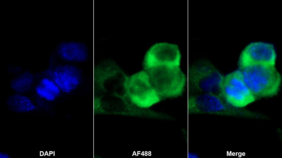 Polyclonal Antibody to Matrix Metalloproteinase 3 (MMP3)