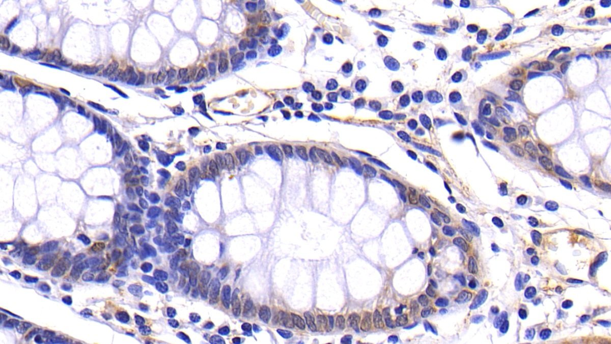 Polyclonal Antibody to Matrix Metalloproteinase 7 (MMP7)