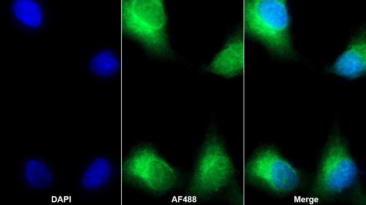 Polyclonal Antibody to Matrix Metalloproteinase 7 (MMP7)