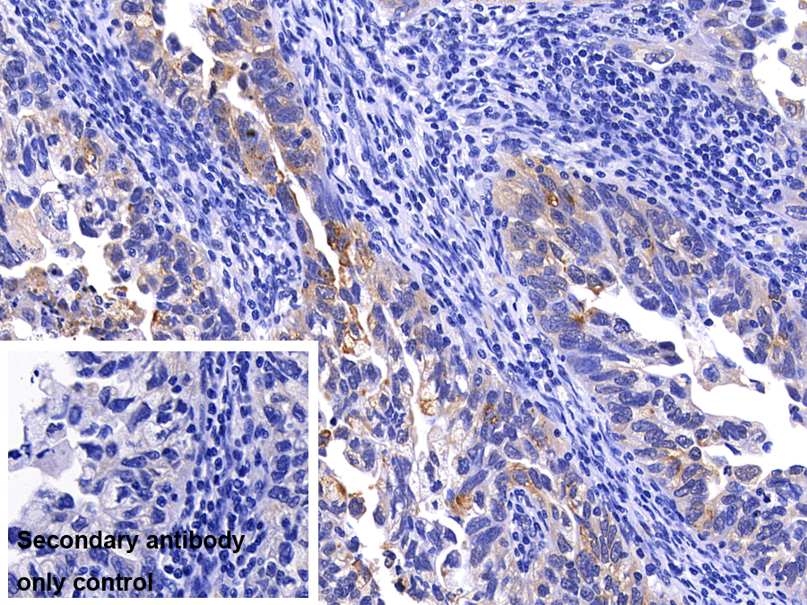 Polyclonal Antibody to Matrix Metalloproteinase 7 (MMP7)