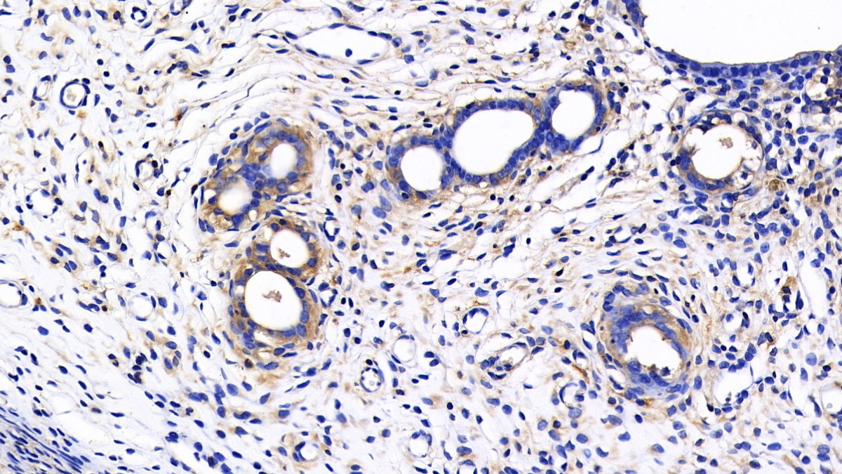 Polyclonal Antibody to Matrix Metalloproteinase 7 (MMP7)