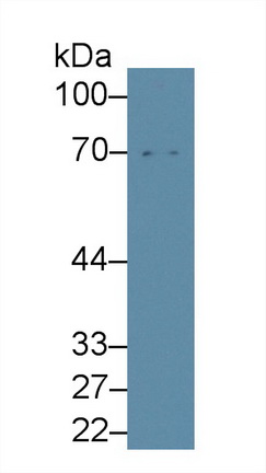 Polyclonal Antibody to Matrix Metalloproteinase 8 (MMP8)