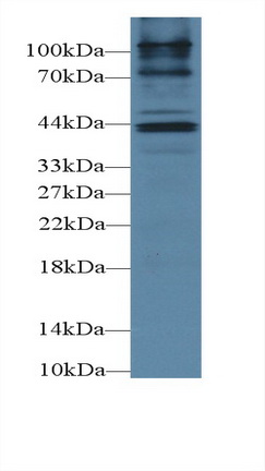 Polyclonal Antibody to Cholecystokinin A Receptor (CCKAR)