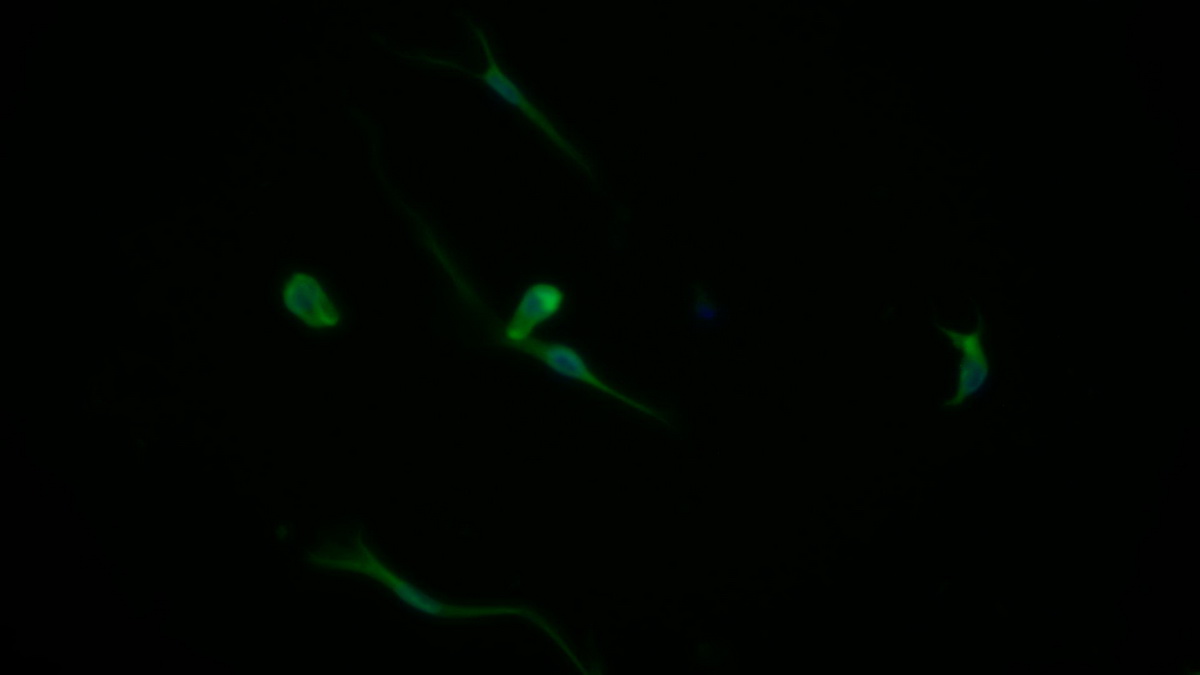 Polyclonal Antibody to Nerve Growth Factor (NGF)