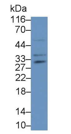 Polyclonal Antibody to Nerve Growth Factor (NGF)