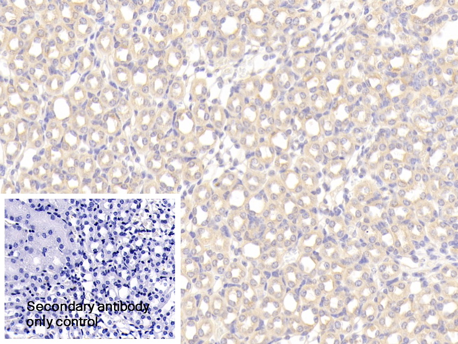 Polyclonal Antibody to Osteoprotegerin (OPG)