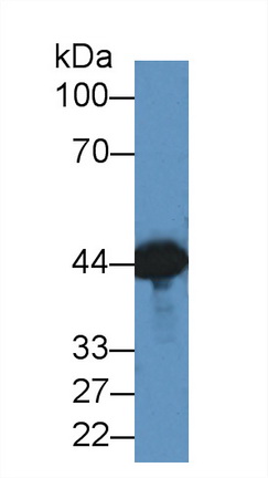 Polyclonal Antibody to Creatine Kinase, Muscle (CKM)