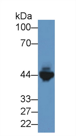 Polyclonal Antibody to Creatine Kinase, Muscle (CKM)