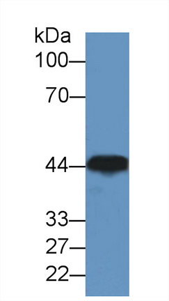 Polyclonal Antibody to Creatine Kinase, Muscle (CKM)