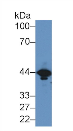 Polyclonal Antibody to Creatine Kinase, Muscle (CKM)