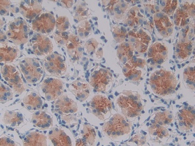 Polyclonal Antibody to Oncostatin M (OSM)