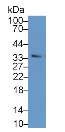 Polyclonal Antibody to Oncostatin M (OSM)